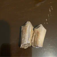 دندان قدیمی