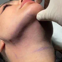 تخفیفات بهاره کلینیک مهرزاد