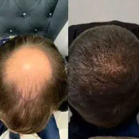الان اقدام کن توی ۴۰ روز نتیجه بگیر