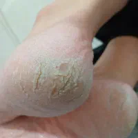 فروش وسایل پدیکور