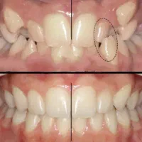 جراحی دندان عقل، عصب کشی، ارتودنسی|خدمات آرایشگری و زیبایی|زنجان, |دیوار