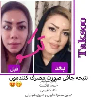 خیلی راحت بدون رژیم سخت چربیسوزی کن|آرایشی، بهداشتی، درمانی|سبزوار, دانشگاه آزاد|دیوار