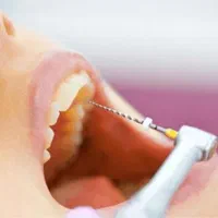 کامپوزیت. لمینت .عصب کشی .مروارید|خدمات آرایشگری و زیبایی|مشکین‌دشت, |دیوار
