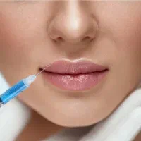 مدل رایگان برای تزریق فیلر لب پزشک متخصص