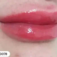 تخفیف ویژه شیدینگ لب