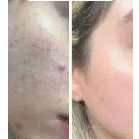 کرم اماراتی عصل مروه گلی|آرایشی، بهداشتی، درمانی|میبد, |دیوار