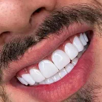 منشی خانوم برای دندان پزشکی