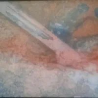 نشت یابی رفع نمزدگی رطوبت بدون خرابی لوله بازکن|خدمات پیشه و مهارت|نیشابور, ابراهیمی|دیوار