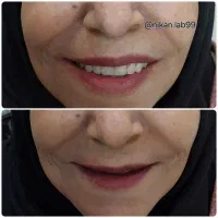 دندانسازی دندان مصنوعی تحویل ۲روزه باضمانت|خدمات آرایشگری و زیبایی|اصفهان, کشاورزی|دیوار