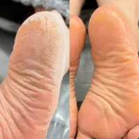 آموزش تخصصی پدیکور غیرحضوری