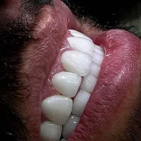 خدمات زیبایی دندانپزشکی