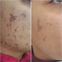 فیشیال تخصصی ویژه روز مادر و زن با بهترین قیمت