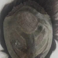 دو عدد پروتز مو