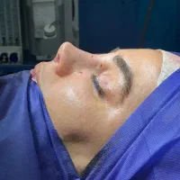 جراحی بینی فقط با۲۹میلیون کلینیک تخصصی