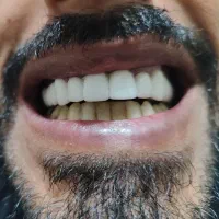 ساخت انواع دندان متحرک و ثابت|خدمات آرایشگری و زیبایی|اهواز, پادادشهر|دیوار