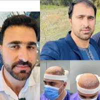 جشنواره ۳۰ درصدی کاشت وابرو وخدمات زیبایی