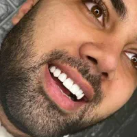 خدمات درمانی و زیبایی دندان|خدمات آرایشگری و زیبایی|کرمانشاه, |دیوار