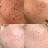 کرم شب|آرایشی، بهداشتی، درمانی|داراب, |دیوار