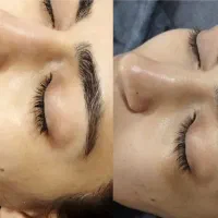 اف پاکسازی صورت