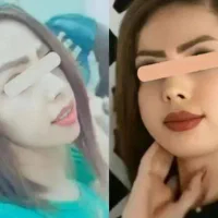 پک گیاهی چاقی صورت و بدن بدون بازگشت
