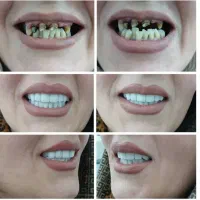 دندانپزشکی با تخفیفات ویژه به مناسبت ماه ربیع