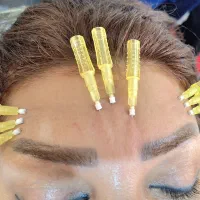 بوتاکس ژل نخ چالگونه مزو انزیم فیلر|خدمات آرایشگری و زیبایی|تبریز, |دیوار