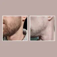 کوسه نباش|آرایشی، بهداشتی، درمانی|اصفهان, چرخاب|دیوار