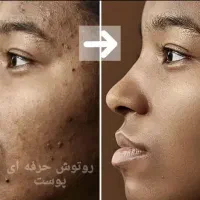 ادیت عکس فتوشاپ تخصصی|خدمات رایانه‌ای و موبایل|زاهدان, |دیوار