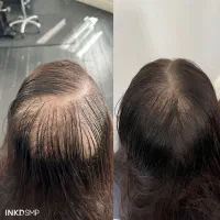 راهکار اکتیو شدن پیازموریش