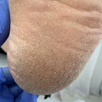 تخفیف٪پدیکورو پاکسازی دست و پارافین تراپی|خدمات آرایشگری و زیبایی|بروجرد, |دیوار