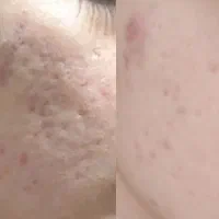 کرم بیوممتیک اصلی