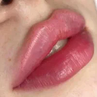 جشنواره تخفیف ژل و بوتاکس کلینیک راد|خدمات آرایشگری و زیبایی|کرج, برغان|دیوار