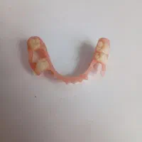 روکش دندان .دندان مصنوعی.کامپوزیت.دندان سازی