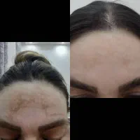 کرم سوپر معجزه