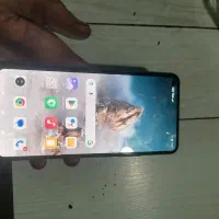 شیاومی 11 لایت سلامت به شرط