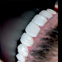 دندانپزشکی بهبهان// پرداخت بدون پیش و بیمه تکمیلی|خدمات آرایشگری و زیبایی|دیلم, |دیوار