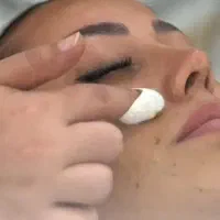 فرمول کرم دست وپاتضمینی