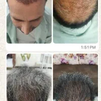 تونیک سوئیسی رویش مجدد