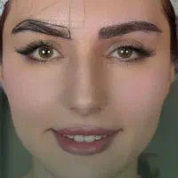 جشنواره نانو گرافت کاشت ابرو با شرایط اقساط ویژه