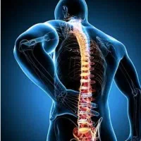 گرفتگی گردن و دست و درد سیاتیک ، زالو ،حجامت ، فصد