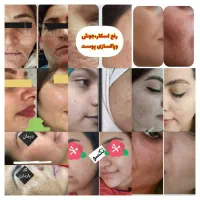 مشاور تخصصی پوست لاغری و چاقی ناباروری