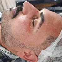 فیشال و پاکسازی پوست|خدمات آرایشگری و زیبایی|اصفهان, دشتستان|دیوار