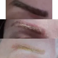 مدل کربوفیشیال(کربن تراپی+فیشال+پلاژن) کلینیکی|خدمات آرایشگری و زیبایی|تهران, گاندی|دیوار