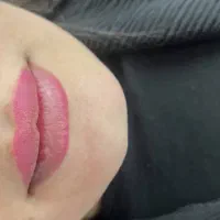 ژل و بوتاکس|خدمات آرایشگری و زیبایی|شوشتر, |دیوار