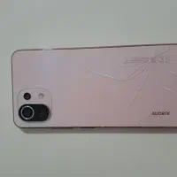 Mi11 Lite
