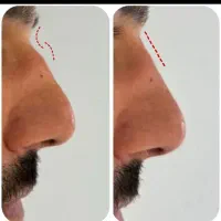 تخفیفات ۵۵% مطب دکتر/ بوتاکس فیلر مزو ژل لب روسی|خدمات آرایشگری و زیبایی|مشهد, هنرستان|دیوار