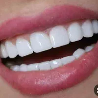 جشنواره کامپوزیت دندان فقط واحدی 700