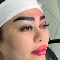 کاشت ابرو دیناز