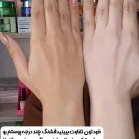 از تیرگی های صورت و بدنت خلاص شو|آرایشی، بهداشتی، درمانی|پشتکوه (سیستان و بلوچستان), |دیوار