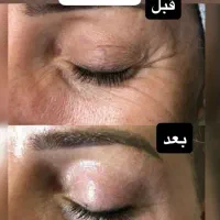 بیوممتیک|حراج|تهران, ترمینال غرب|دیوار